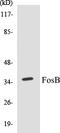FosB Proto-Oncogene, AP-1 Transcription Factor Subunit antibody, EKC1221, Boster Biological Technology, Western Blot image 
