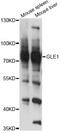 GLE1 RNA Export Mediator antibody, LS-C748267, Lifespan Biosciences, Western Blot image 