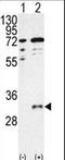 Carboxy-terminal domain RNA polymerase II polypeptide A small phosphatase 1 antibody, LS-C101056, Lifespan Biosciences, Western Blot image 