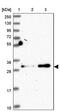 Galectin 9B antibody, PA5-61361, Invitrogen Antibodies, Western Blot image 