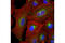 RAB11A, Member RAS Oncogene Family antibody, 5589S, Cell Signaling Technology, Immunocytochemistry image 