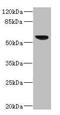 Sterol O-Acyltransferase 2 antibody, LS-C676531, Lifespan Biosciences, Western Blot image 