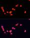 Cyclin Dependent Kinase 5 Regulatory Subunit 1 antibody, LS-C749498, Lifespan Biosciences, Immunofluorescence image 