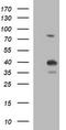 Uracil Phosphoribosyltransferase Homolog antibody, TA506874S, Origene, Western Blot image 