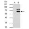 Matrix Metallopeptidase 8 antibody, NBP2-17316, Novus Biologicals, Immunoprecipitation image 