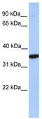 Monoacylglycerol O-Acyltransferase 1 antibody, TA342082, Origene, Western Blot image 