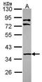 LIM Zinc Finger Domain Containing 1 antibody, GTX114984, GeneTex, Western Blot image 