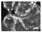 Collagen Type XVII Alpha 1 Chain antibody, AP02251PU-S, Origene, Immunofluorescence image 