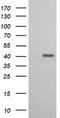 3-ketoacyl-CoA thiolase, mitochondrial antibody, TA506155AM, Origene, Western Blot image 
