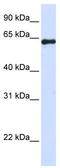 DENN Domain Containing 6A antibody, TA337641, Origene, Western Blot image 