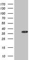 2,4-Dienoyl-CoA Reductase 1 antibody, CF808947, Origene, Western Blot image 