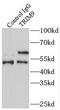 Tripartite Motif Containing 9 antibody, FNab08995, FineTest, Immunoprecipitation image 