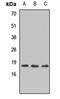 DNA Polymerase Epsilon 4, Accessory Subunit antibody, orb412918, Biorbyt, Western Blot image 