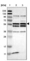 2'-5'-Oligoadenylate Synthetase Like antibody, NBP1-87363, Novus Biologicals, Western Blot image 