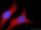 Receptor-interacting serine/threonine-protein kinase 1 antibody, 17519-1-AP, Proteintech Group, Immunofluorescence image 
