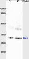 BMP and activin membrane-bound inhibitor homolog antibody, GTX51308, GeneTex, Western Blot image 