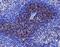 CD27 Molecule antibody, A01148-2, Boster Biological Technology, Immunohistochemistry paraffin image 