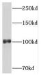 Amyloid Beta Precursor Protein Binding Family B Member 1 Interacting Protein antibody, FNab07291, FineTest, Western Blot image 