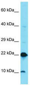 Dual Specificity Phosphatase 22 antibody, TA344334, Origene, Western Blot image 