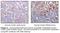 Bruton Tyrosine Kinase antibody, LS-C47221, Lifespan Biosciences, Immunohistochemistry paraffin image 