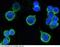 ERBB2 antibody, 10004-R511, Sino Biological, Immunohistochemistry frozen image 