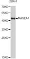 Melanoma-associated antigen 1 antibody, A5470, ABclonal Technology, Western Blot image 