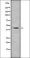 Myosin Light Chain 6B antibody, orb337818, Biorbyt, Western Blot image 