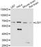 Leucine-rich glioma-inactivated protein 1 antibody, A5408, ABclonal Technology, Western Blot image 