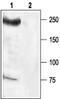 Sodium Voltage-Gated Channel Alpha Subunit 8 antibody, PA5-77728, Invitrogen Antibodies, Western Blot image 