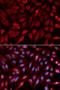 Syndecan Binding Protein antibody, LS-C334009, Lifespan Biosciences, Immunofluorescence image 