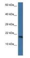 PNKD Metallo-Beta-Lactamase Domain Containing antibody, NBP1-74205, Novus Biologicals, Western Blot image 