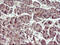 Uracil Phosphoribosyltransferase Homolog antibody, M09616, Boster Biological Technology, Immunohistochemistry paraffin image 