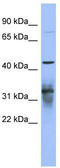 Poly(A) Binding Protein Cytoplasmic 5 antibody, TA343974, Origene, Western Blot image 