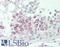 Serine Peptidase Inhibitor, Kunitz Type 2 antibody, LS-B9221, Lifespan Biosciences, Immunohistochemistry paraffin image 