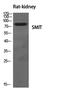 Solute Carrier Family 5 Member 3 antibody, PA5-51062, Invitrogen Antibodies, Western Blot image 