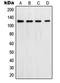 DNA polymerase delta catalytic subunit antibody, LS-C352678, Lifespan Biosciences, Western Blot image 