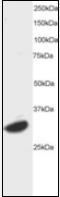 Cyclic AMP-dependent transcription factor ATF-7 antibody, orb88419, Biorbyt, Western Blot image 