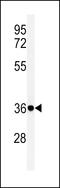 Fc-gamma RI antibody, 61-719, ProSci, Western Blot image 