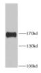 Histone Deacetylase 6 antibody, FNab03803, FineTest, Western Blot image 