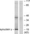 SNCG antibody, LS-B7047, Lifespan Biosciences, Western Blot image 