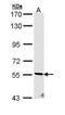 Serine/Threonine Kinase 32C antibody, GTX111982, GeneTex, Western Blot image 