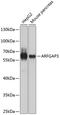 ADP-ribosylation factor GTPase-activating protein 3 antibody, 23-461, ProSci, Western Blot image 