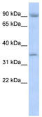 NFKB Inhibitor Beta antibody, TA335821, Origene, Western Blot image 