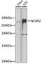 Nuclear Receptor Corepressor 2 antibody, 23-548, ProSci, Western Blot image 