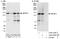 Zinc Finger And BTB Domain Containing 11 antibody, A303-240A, Bethyl Labs, Immunoprecipitation image 
