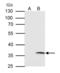 Voltage-dependent anion-selective channel protein 2 antibody, GTX104745, GeneTex, Immunoprecipitation image 