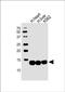 Hemoglobin Subunit Beta antibody, PA5-48233, Invitrogen Antibodies, Western Blot image 