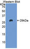 Coagulation Factor XI antibody, LS-C293403, Lifespan Biosciences, Western Blot image 