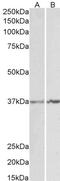 Apolipoprotein L2 antibody, 46-762, ProSci, Enzyme Linked Immunosorbent Assay image 
