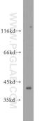 Zinc Finger Protein 385D antibody, 20806-1-AP, Proteintech Group, Western Blot image 